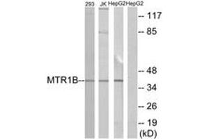 Western blot analysis of extracts from 293/Jurkat/HepG2 cells, using MTR1B Antibody. (Melatonin Receptor 1B anticorps  (AA 301-350))