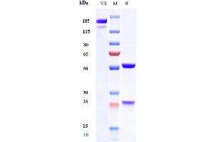 Anti- Human TSLP( Tezepelumab) on SDS-PAGE under reducing (R) condition. (Recombinant TSLP (Tezepelumab Biosimilar) anticorps)