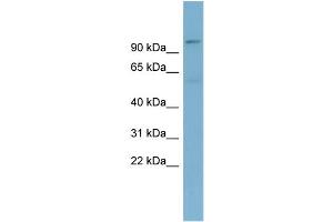 WB Suggested Anti-TBL3  Antibody Titration: 0. (TBL3 anticorps  (N-Term))