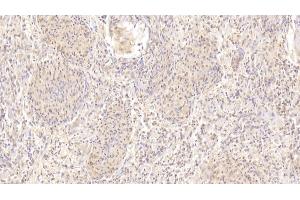 anti-Cadherin 23 (CDH23) (AA 34-236) antibody