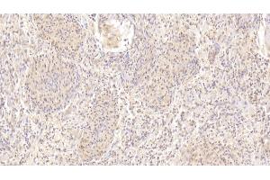 Detection of CDH23 in Human Spleen Tissue using Polyclonal Antibody to Cadherin 23 (CDH23) (CDH23 anticorps  (AA 34-236))