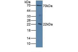 Detection of IL1RAP in Human Serum using Polyclonal Antibody to Interleukin 1 Receptor Accessory Protein (IL1RAP) (IL1RAP anticorps  (AA 420-558))