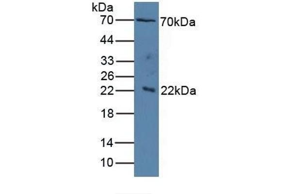 IL1RAP antibody  (AA 420-558)