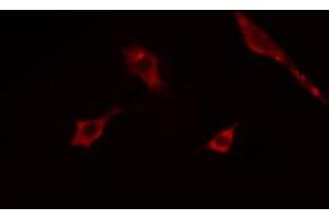 ABIN6268898 staining COLO205  cells by IF/ICC. (ACTG2 anticorps  (N-Term))