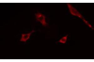 ABIN6268898 staining COLO205  cells by IF/ICC.