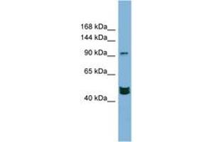 Image no. 1 for anti-Mastermind-Like 3 (MAML3) (AA 791-840) antibody (ABIN6742125) (MAML3 anticorps  (AA 791-840))