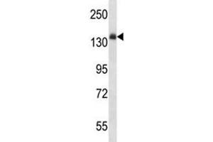 Anti-Insulin Receptor antibody western blot analysis in mouse liver tissue lysate.