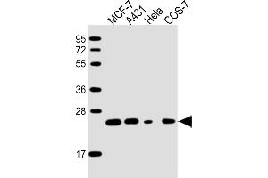 All lanes : Anti-RAB21 Antibody at 1:2000 dilution Lane 1: MCF-7 whole cell lysate Lane 2: A431 whole cell lysate Lane 3: Hela whole cell lysate Lane 4: COS-7 whole cell lysate Lysates/proteins at 20 μg per lane. (RAB21 anticorps  (AA 1-225))