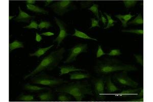 Immunofluorescence of monoclonal antibody to HEXIM1 on HeLa cell.