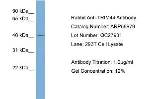 WB Suggested Anti-TRIM44  Antibody Titration: 0. (TRIM44 anticorps  (Middle Region))