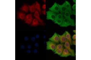 ABIN6261687 and ABIN6277900 staining Hela cells by IF/ICC. (SLC27A1 anticorps  (Internal Region))