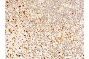 ABIN6267273 at 1/100 staining human appendiceal tissue sections by IHC-P. (Lamin A/C anticorps  (pSer392))