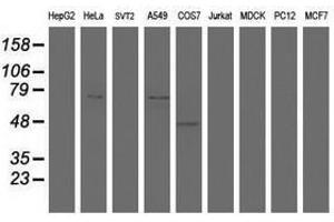 Image no. 1 for anti-HBS1-Like (HBS1L) (AA 1-260) antibody (ABIN1490655) (HBS1L anticorps  (AA 1-260))