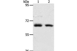 Western Blot analysis of Human fetal kidney and fetal lung tissue using ACOT11 Polyclonal Antibody at dilution of 1:450 (ACOT11 anticorps)
