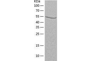 Adenylosuccinate Lyase (ADSL) (AA 1-484) protein (His-IF2DI Tag)