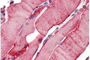 Human Skeletal Muscle (formalin-fixed, paraffin-embedded) stained with Heat Shock Protein 27 (HSP27) antibody ABIN462101 at 10 ug/ml followed by biotinylated goat anti-rabbit IgG secondary antibody ABIN481713, alkaline phosphatase-streptavidin and chromogen. (HSP27 anticorps)