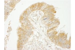 Immunohistochemistry (IHC) image for anti-ADP-Ribosylation Factor Guanine Nucleotide-Exchange Factor 2 (Brefeldin A-Inhibited) (ARFGEF2) (AA 300-350) antibody (ABIN7448437)