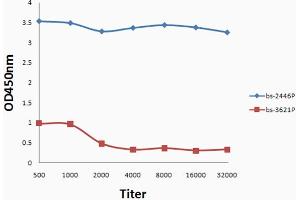 Antigen:, P [SG(p-S)TT], 0.