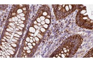 ABIN6272972 at 1/100 staining Mouse colon tissue by IHC-P. (OSBP anticorps  (Internal Region))