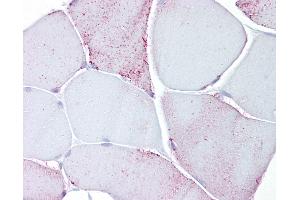 Anti-PYGM / Phosphorylase b antibody IHC of human skeletal muscle.