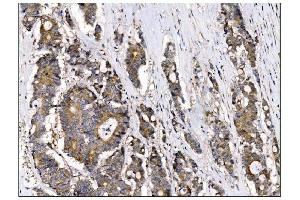 IHC analysis of AS160/TBC1D4 using anti-AS160/TBC1D4 antibody (ABIN7599745). (TBC1D4 anticorps  (AA 1118-1298))