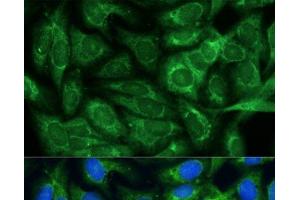 Immunofluorescence analysis of U-2 OS cells using MTHFD2 Polyclonal Antibody at dilution of 1:100.