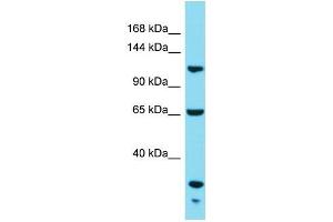 Western Blotting (WB) image for anti-KIAA1522 (KIAA1522) (C-Term) antibody (ABIN2791616) (KIAA1522 anticorps  (C-Term))