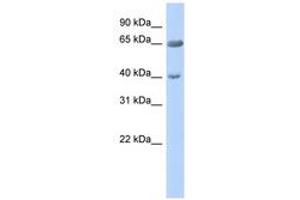 Image no. 1 for anti-Zinc Finger Protein 226 (ZNF226) (AA 575-624) antibody (ABIN6740439) (ZNF226 anticorps  (AA 575-624))