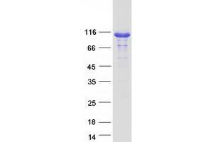 Validation with Western Blot