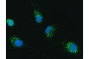 IF analysis of TRK fused gene/TFG using anti-TRK fused gene/TFG antibody (ABIN7599839). (TFG anticorps  (AA 121-400))