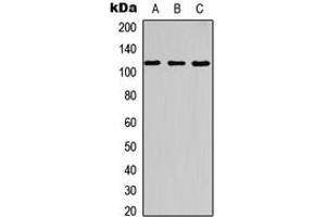 Western blot analysis of c-CBL (pY700) expression in HT29 UV-treated (A), NIH3T3 (B), rat kidney (C) whole cell lysates. (CBL anticorps  (C-Term, pTyr700))