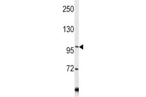 Western Blotting (WB) image for anti-Collagen, Type VI, alpha 1 (COL6A1) antibody (ABIN3002700) (COL6A1 anticorps)