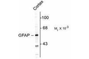 Image no. 1 for anti-Glial Fibrillary Acidic Protein (GFAP) antibody (ABIN303954)