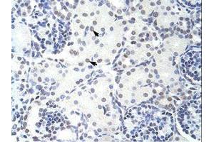 Image no. 1 for anti-Glucocorticoid Modulatory Element Binding Protein 2 (GMEB2) (C-Term) antibody (ABIN202723)