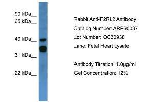 WB Suggested Anti-F2RL2  Antibody Titration: 0. (F2RL2 anticorps  (C-Term))