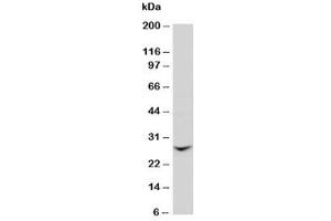 Western blot testing of GJB2 antibody and rat liver tissue lysate (GJB2 anticorps  (N-Term))
