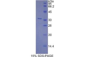 SDS-PAGE analysis of Rat MYH3 Protein.