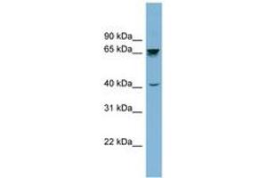 Image no. 1 for anti-Acetylcholinesterase (AChE) (AA 359-408) antibody (ABIN6741992) (Acetylcholinesterase anticorps  (AA 359-408))