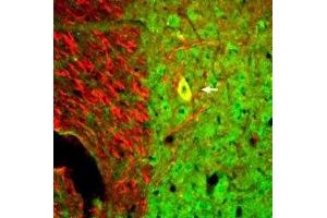 Expression of Neurotrophin 3 in mouse spinal cord - Immunohistochemical staining of perfusion-fixed frozen mouse spinal cord sections with Anti-Neurotrophin 3 (NT-3) Antibody (ABIN7043392, ABIN7044748 and ABIN7044749), (1:300), followed by goat-anti-rabbit-AlexaFluor-488 (green).