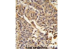 Immunohistochemistry (IHC) image for anti-Junction Plakoglobin (JUP) antibody (ABIN3003996) (JUP anticorps)