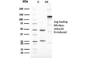 SDS-PAGE Analysis Purified Mammaglobin Recombinant Rabbit Monoclonal (MGB1/2123R). (Recombinant Mammaglobin A anticorps)