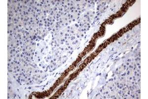Image no. 1 for anti-Tuberous Sclerosis 1 (TSC1) (AA 836-1164) antibody (ABIN1491685) (TSC1 anticorps  (AA 836-1164))