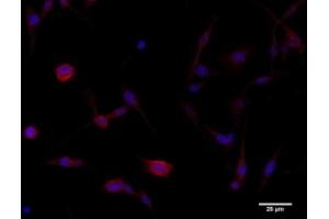 Immunofluorescence (IF) image for anti-Catenin, beta (CATNB) (C-Term) antibody (ABIN6254224)