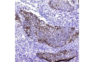 IHC analysis of Periplakin using anti-Periplakin antibody (ABIN5518787). (PPL anticorps  (C-Term))