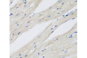 Immunohistochemistry of paraffin-embedded Mouse heart using NAA50 Polyclonal Antibody at dilution of 1:200 (40x lens). (NAA50 anticorps)