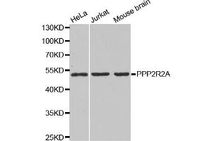 Western blot analysis of extracts of various cell lines, using PPP2R2A antibody (ABIN6291584) at 1:1000 dilution.