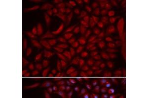 Immunofluorescence analysis of U2OS cells using CUL5 Polyclonal Antibody (Cullin 5 anticorps)