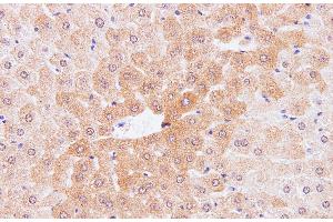 Immunohistochemistry of paraffin-embedded Mouse liver using IL2 Polyclonal Antibody at dilution of 1:100 (IL-2 anticorps)