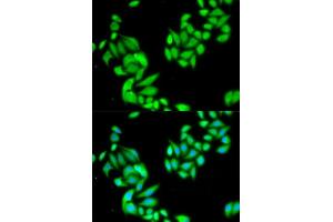 Immunofluorescence analysis of HeLa cell using IKBKB antibody.