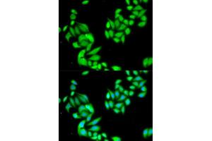 Immunofluorescence analysis of HeLa cell using IKBKB antibody. (IKBKB anticorps  (AA 630-730))